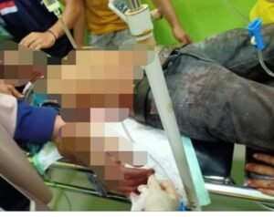 Gegara Perbaiki Pipa Saluran Air, Warga Dusun Baru Ditebas Parang Hingga Bersimbah Darah